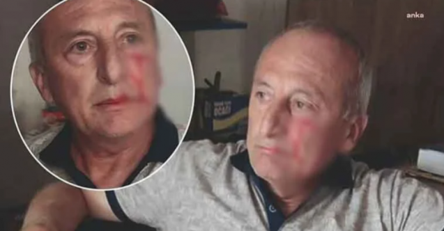 CHP'li belediye başkanına saldırı!